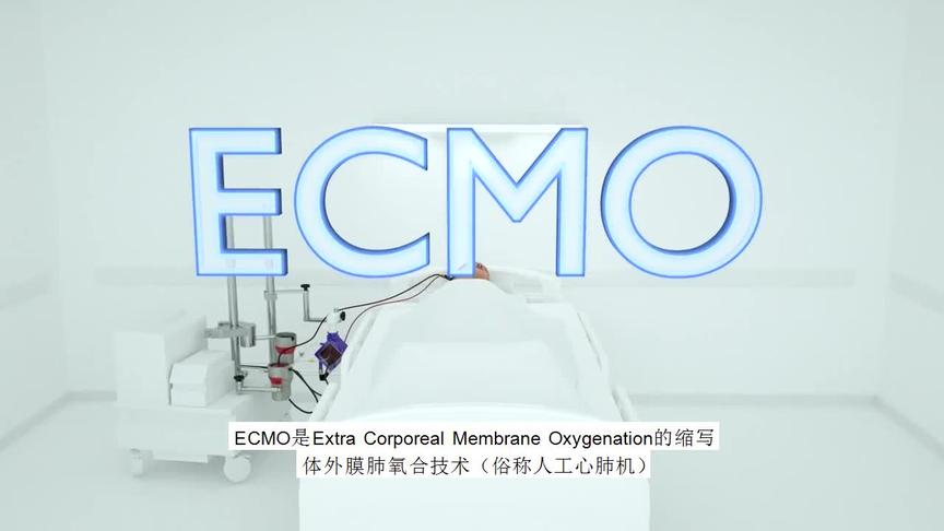 [图]ECMO技术动画 人工心肺机 为新冠肺炎病危患者挽回生命带来希望