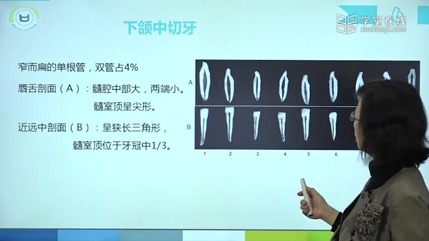 [图]【口腔解剖】第二章 牙体解剖生理-牙髓腔解剖-前牙