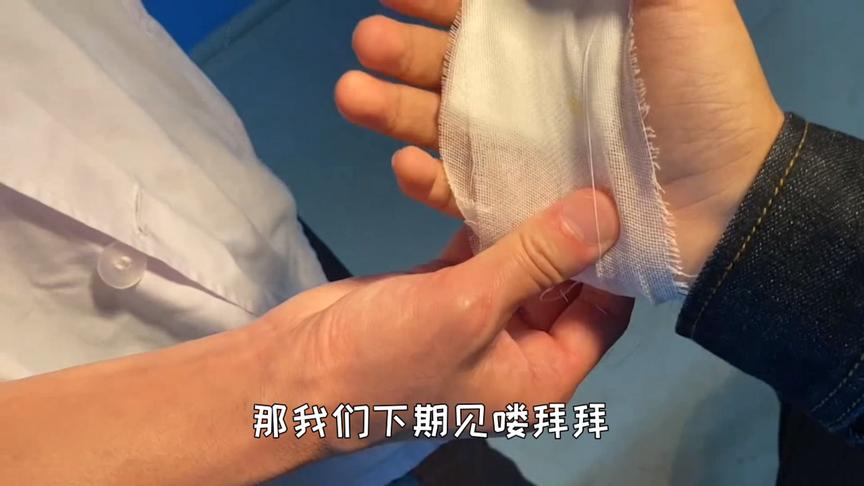 炮芯去医院拆线，医生叔叔轻一点，我还要打游戏呢